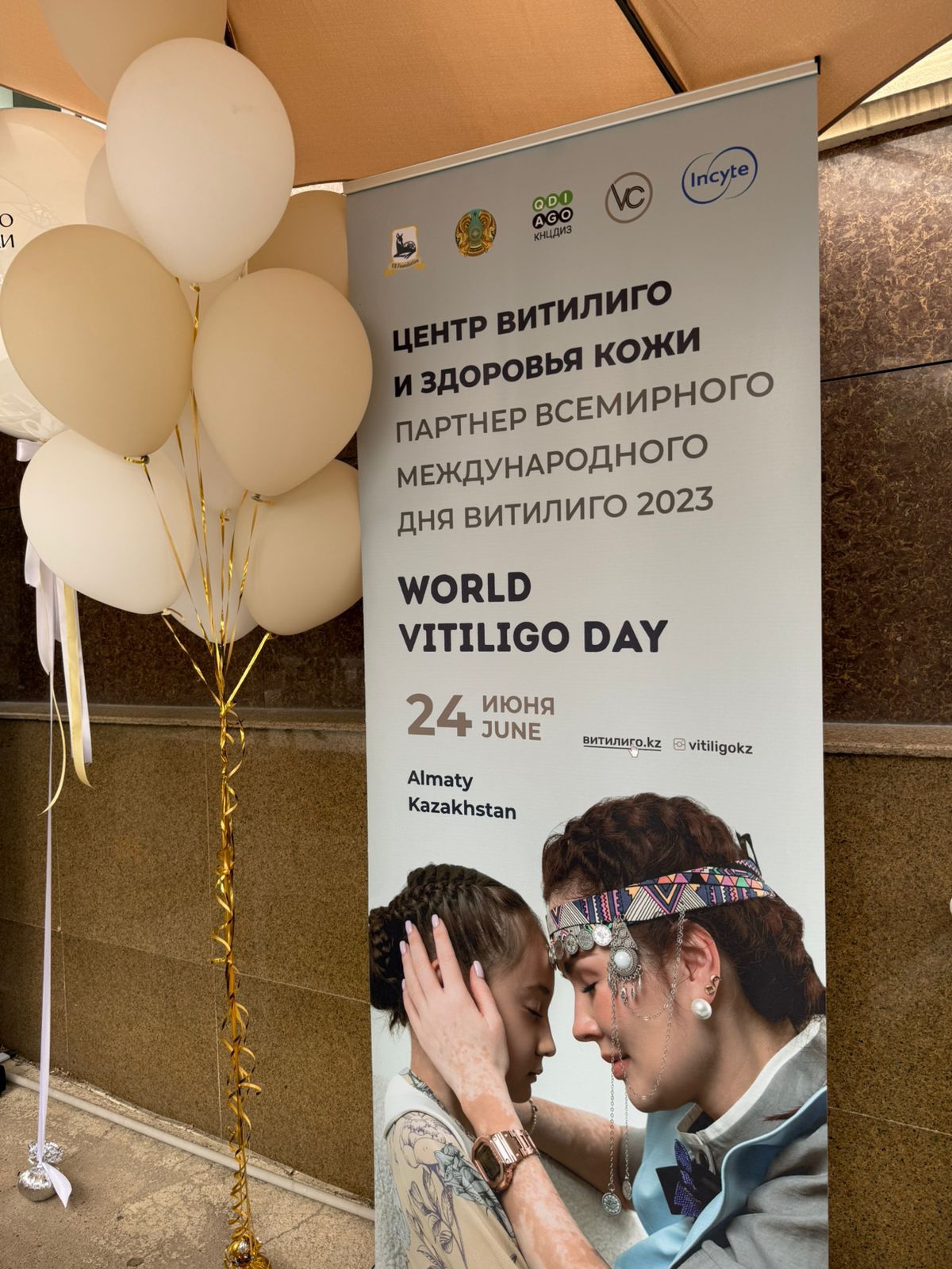 Зиянды емес тері ауруы: Алматыда Витилиго күні атап өтілді