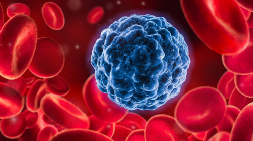 Қанның қатерлі ісігін емдейтін озық орталық