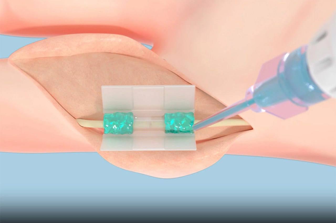 Ерекше емдеу әдісі