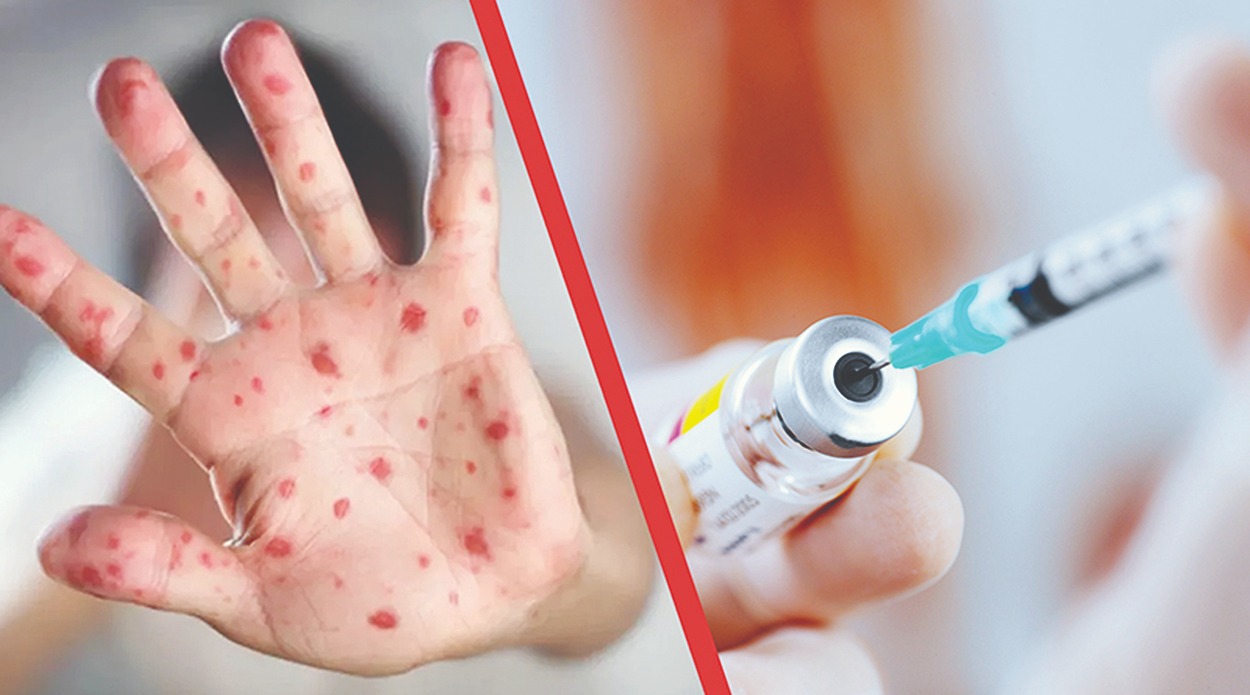 Елімізде қызылшаға қарсы вакцинация науқаны тоқтады ма?