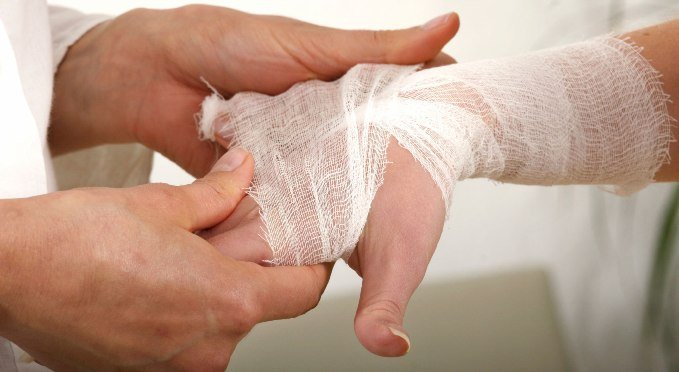 Қолы шипа Сейсепкүл