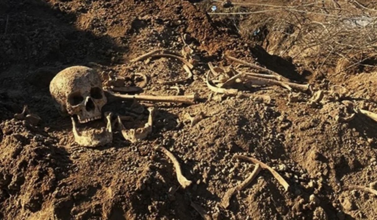 Шемонаихадағы аурухана алаңынан табылған сүйектер елді дүрліктірді